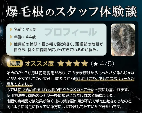 爆毛根のスタッフ体験談