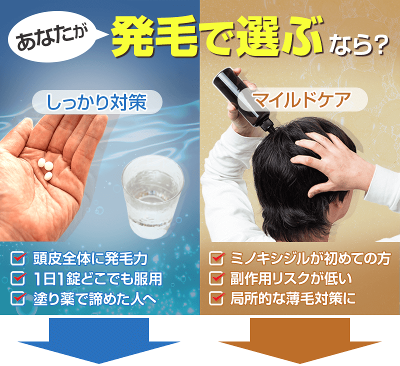 あなたが発毛で選ぶならどのミノキシジル