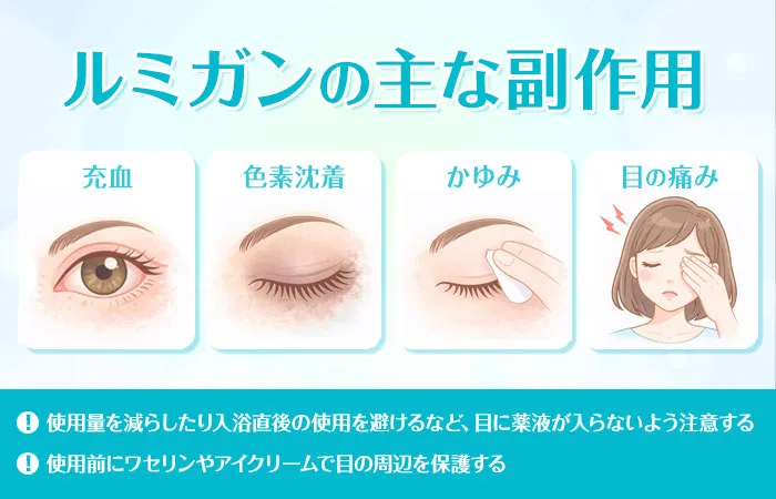 ルミガンの主な副作用