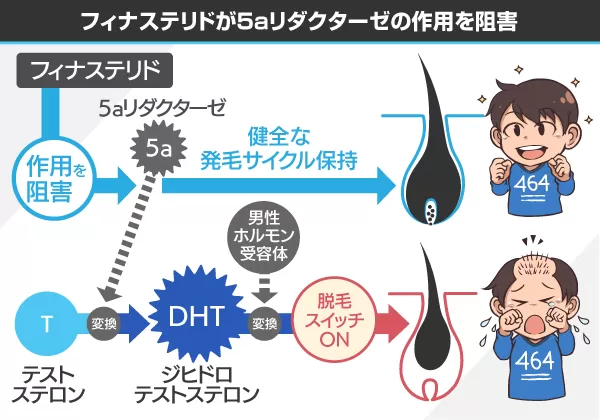フィナスト