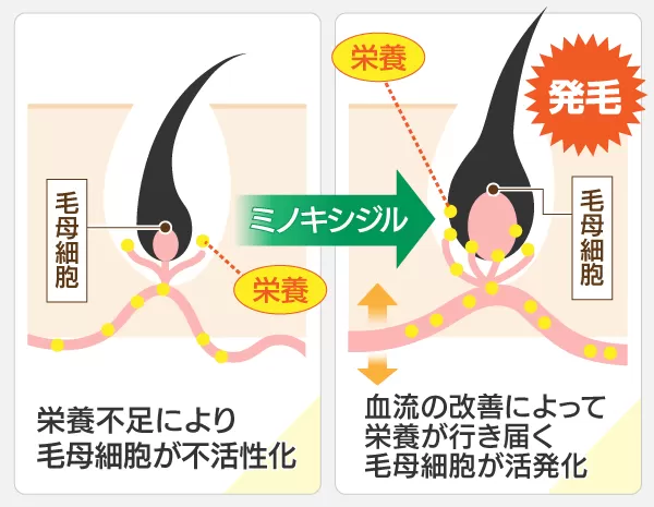 ミノクソール