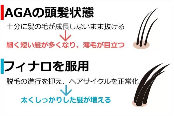 フィナロ