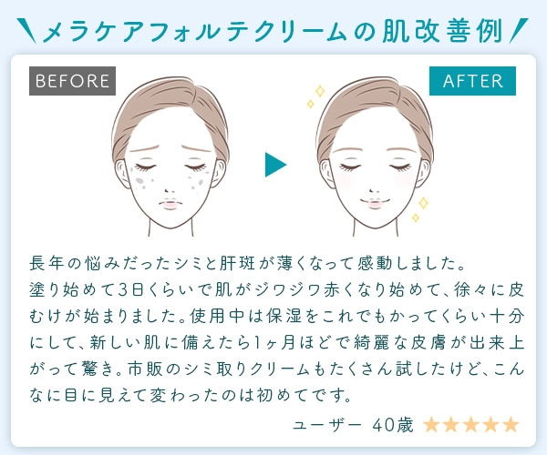 【送料無料】メラケアフォルテクリーム