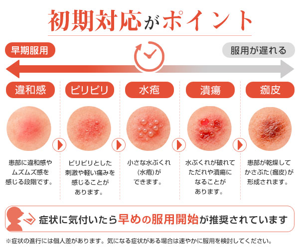 バルクロビル